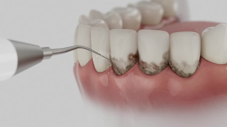 Trusted Dental Implants service in Lake Andes, SD - Dentist Open Now